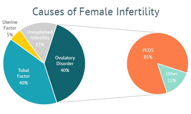 Causes of female infertility Causes of female infertility